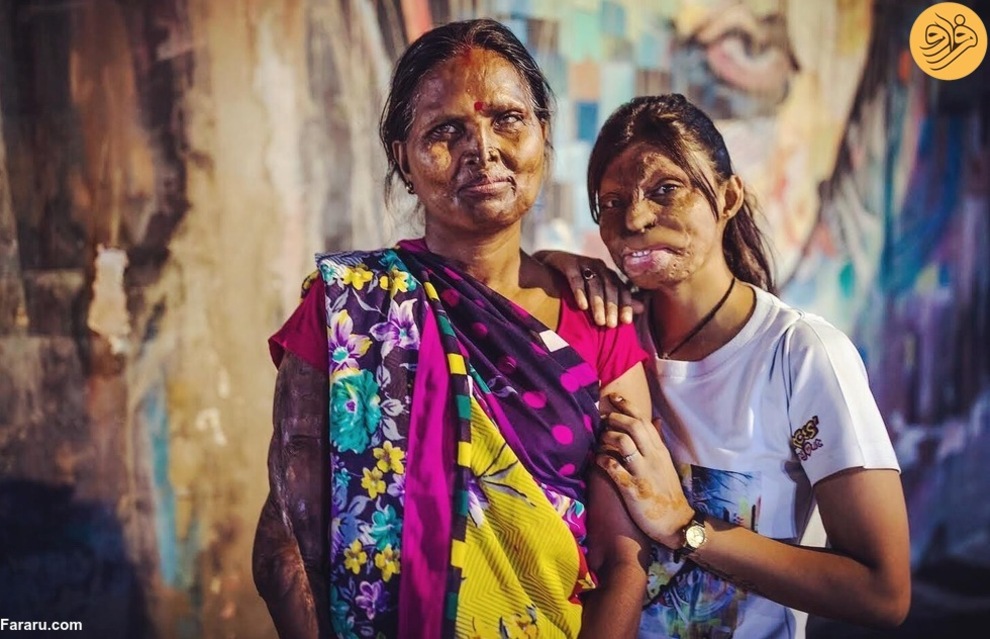 کافهای که توسط دختران قربانی اسیدپاشی اداره میشود