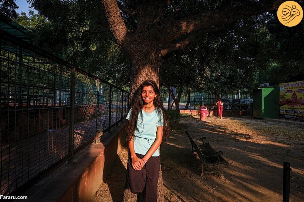 کافهای که توسط دختران قربانی اسیدپاشی اداره میشود