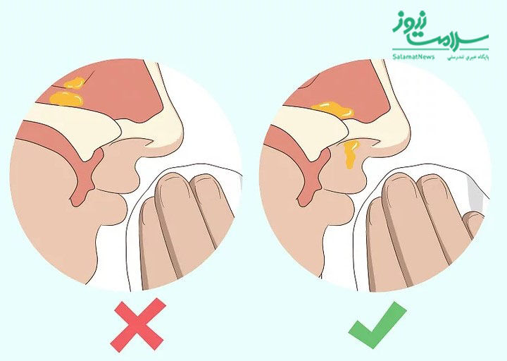 9 ترفند ساده برای درمان‌ فوری گرفتگی بینی