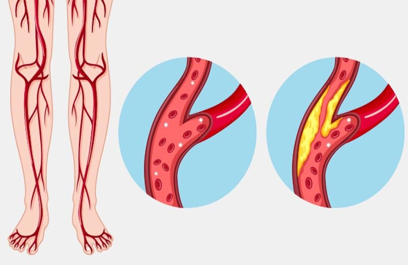 علت سردی پاها در برخی افراد چیست؟