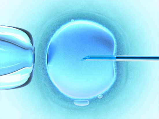 تعیین جنسیت با ivf امکان ‌پذیر است یا خیر؟