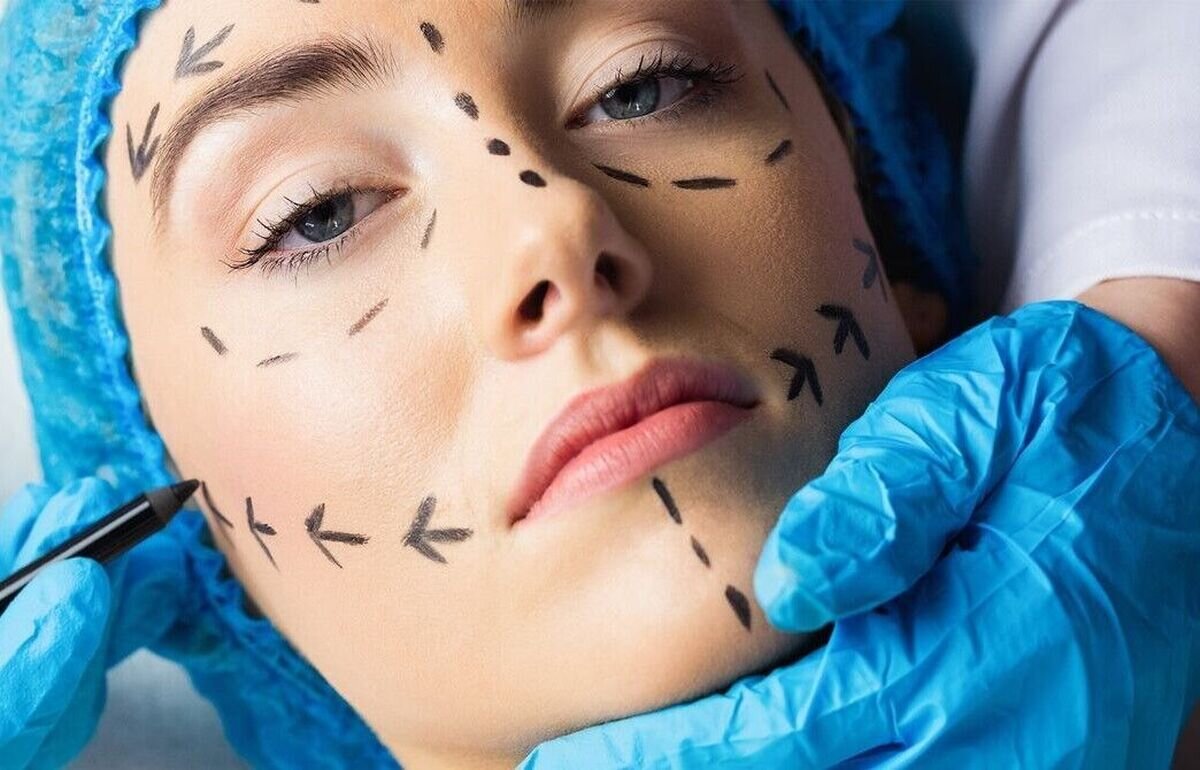 جراحی زیبایی در ایران؛ از قصور پزشکی تا ضرورت نظارت/ «پزشکان عمومی از انجام هرگونه جراحی زیبایی خودداری کنند»/ افزایش شکایات قصور پزشکی در سال گذشته