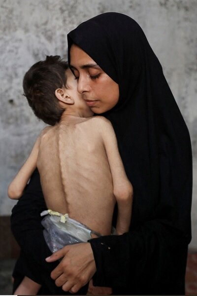 رنج مادران غزه؛ فریادی که باید شنیده شود